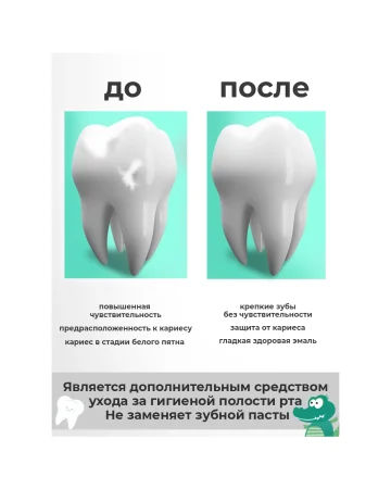 Гель для зубов реминерализующий для детей и подростков 0+ Calcium 50г STOMATOL 